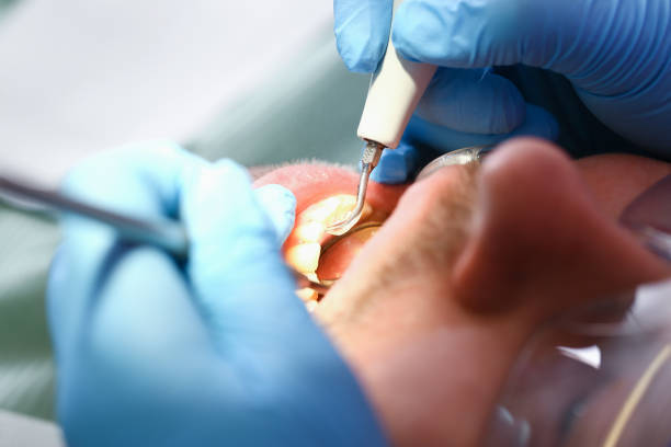 Best Cracked Tooth Emergency Dentist  in Holtsville, NY
