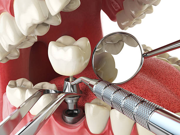 Best Root Canal Emergency Dentist  in Holtsville, NY